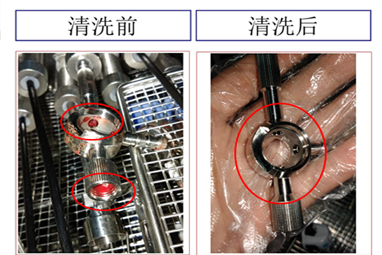 真空超聲波清洗機,輕松解決醫(yī)療器械清洗難題